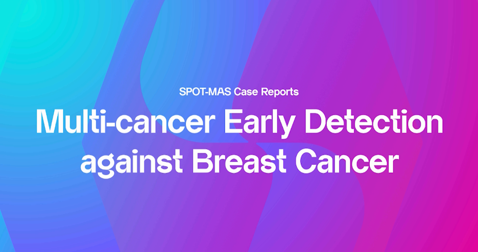 Outsmarting Breast Cancer with Multi-Omics ctDNA